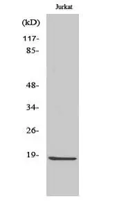 WB analysis of Jurkat cells treated with etoposide using GTX86956 Caspase 2 (cleaved Gly170) antibody. WB analysis of Jurkat cells treated with etoposide using GTX86956 Caspase 2 (cleaved Gly170) antibody.