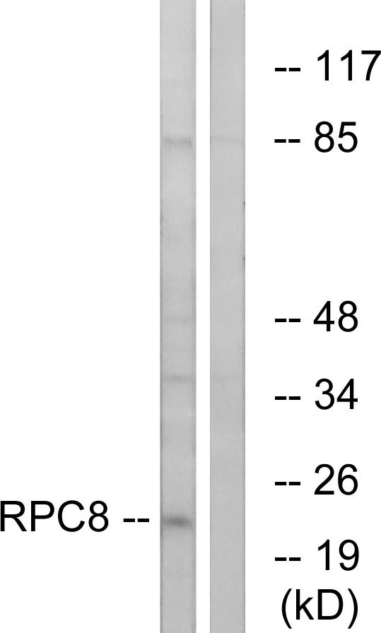 WB analysis of K562 cell lysates using GTX86969 POLR3H antibody. The lane on the right is blocked with the synthesized peptide. WB analysis of K562 cell lysates using GTX86969 POLR3H antibody. The lane on the right is blocked with the synthesized peptide.