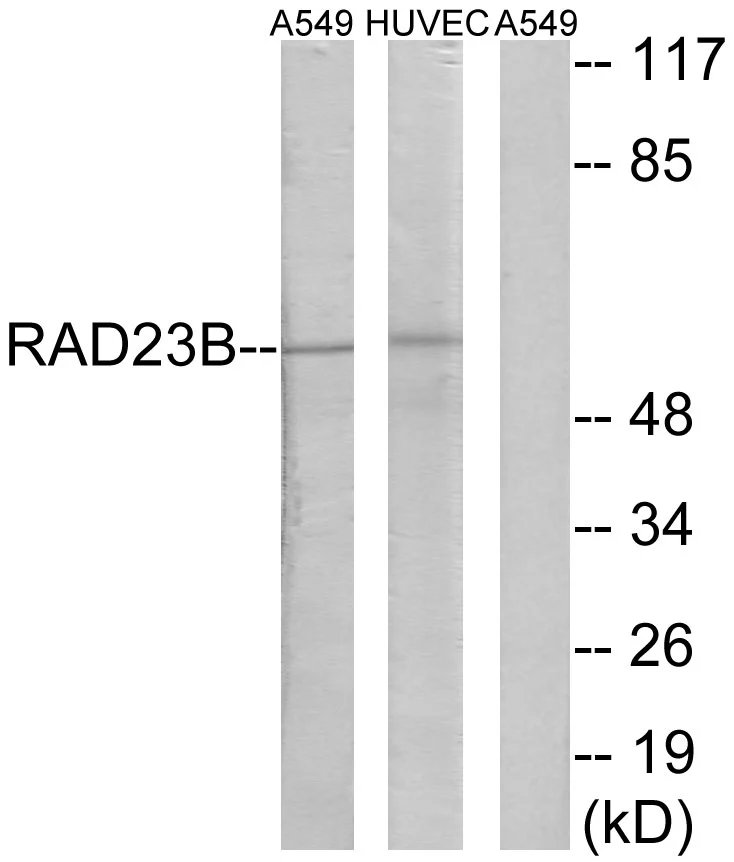 WB analysis of A549 and HUVEC cell lysates using GTX86971 RAD23B antibody. The lane on the right is blocked with the synthesized peptide. WB analysis of A549 and HUVEC cell lysates using GTX86971 RAD23B antibody. The lane on the right is blocked with the synthesized peptide.