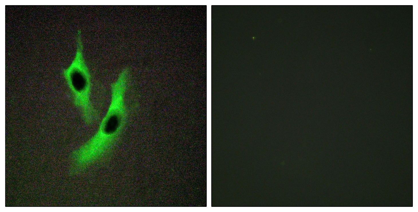 ICC/IF analysis of HeLa cells using GTX86977 STEAP4 antibody. The picture on the right is blocked with the synthesized peptide. ICC/IF analysis of HeLa cells using GTX86977 STEAP4 antibody. The picture on the right is blocked with the synthesized peptide.