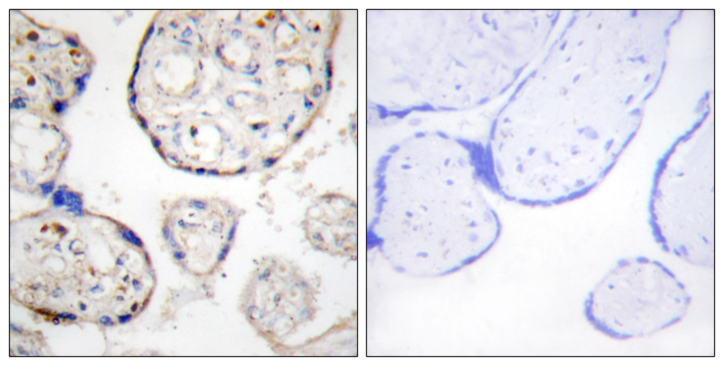 IHC-P analysis of human placenta tissue using GTX86977 STEAP4 antibody. The picture on the right is blocked with the synthesized peptide.
