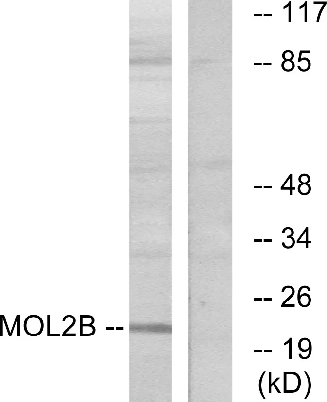 WB analysis of COLO cell lysates using GTX86990 MOL2B antibody. The lane on the right is blocked with the synthesized peptide.
