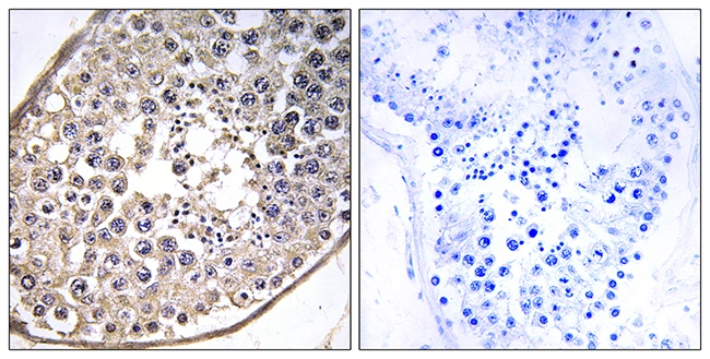 IHC-P analysis of human testis tissue using GTX86991 DNAL4 antibody. The picture on the right is blocked with the synthesized peptide. IHC-P analysis of human testis tissue using GTX86991 DNAL4 antibody. The picture on the right is blocked with the synthesized peptide.