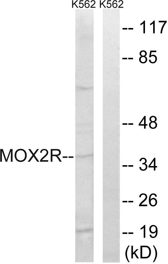 WB analysis of K562 cell lysates using GTX86998 CD200R antibody. The lane on the right is blocked with the synthesized peptide. WB analysis of K562 cell lysates using GTX86998 CD200R antibody. The lane on the right is blocked with the synthesized peptide.