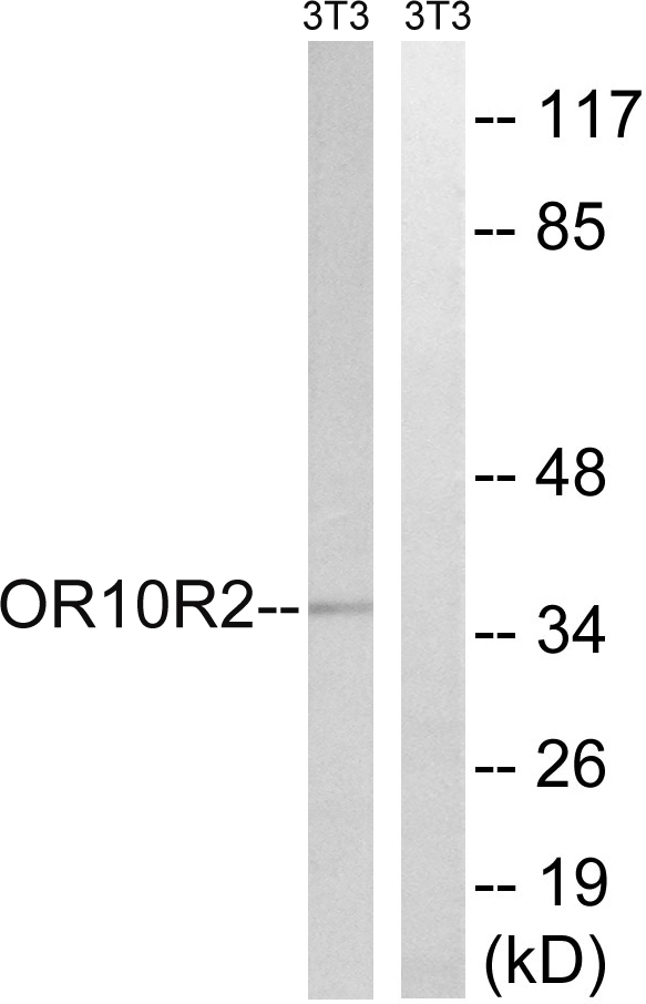 WB analysis of NIH/3T3 cell lysates using GTX86999 MAGEA5 antibody. The lane on the right is blocked with the synthesized peptide. WB analysis of NIH/3T3 cell lysates using GTX86999 MAGEA5 antibody. The lane on the right is blocked with the synthesized peptide.