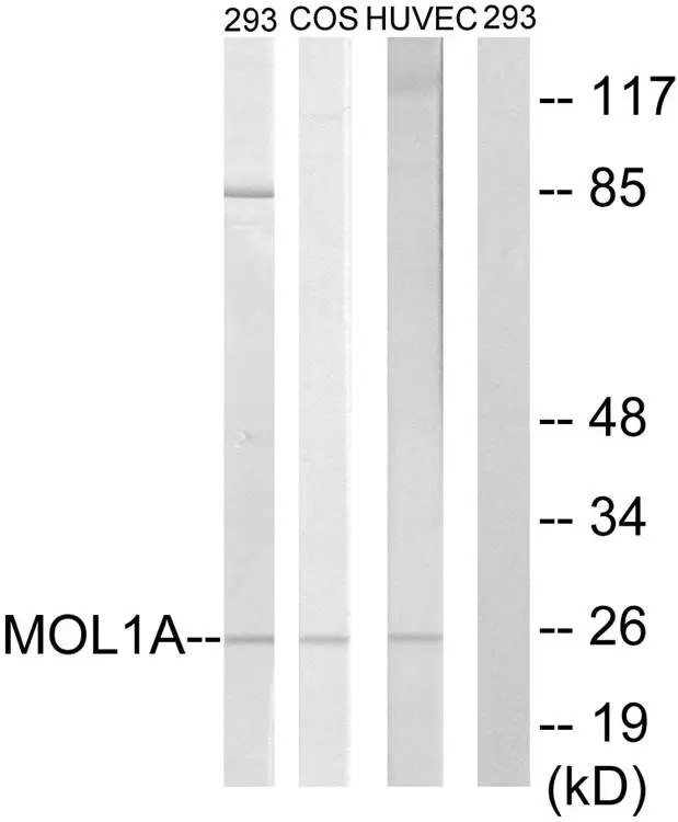 WB analysis of 293,COS7,and HUVEC cells treated with IFN lysate using GTX87003 MOB1B antibody. The lane on the right is blocked with the synthesized peptide.