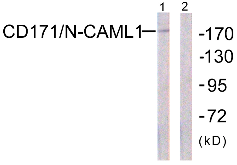 WB analysis of K562 cell lysates using GTX87010 L1CAM antibody. The lane on the right is blocked with the synthesized peptide.