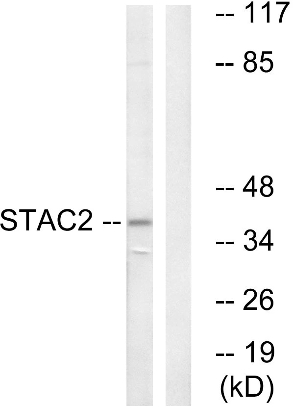 WB analysis of K562 cell lysates using GTX87012 STAC2 antibody. The lane on the right is blocked with the synthesized peptide. WB analysis of K562 cell lysates using GTX87012 STAC2 antibody. The lane on the right is blocked with the synthesized peptide.