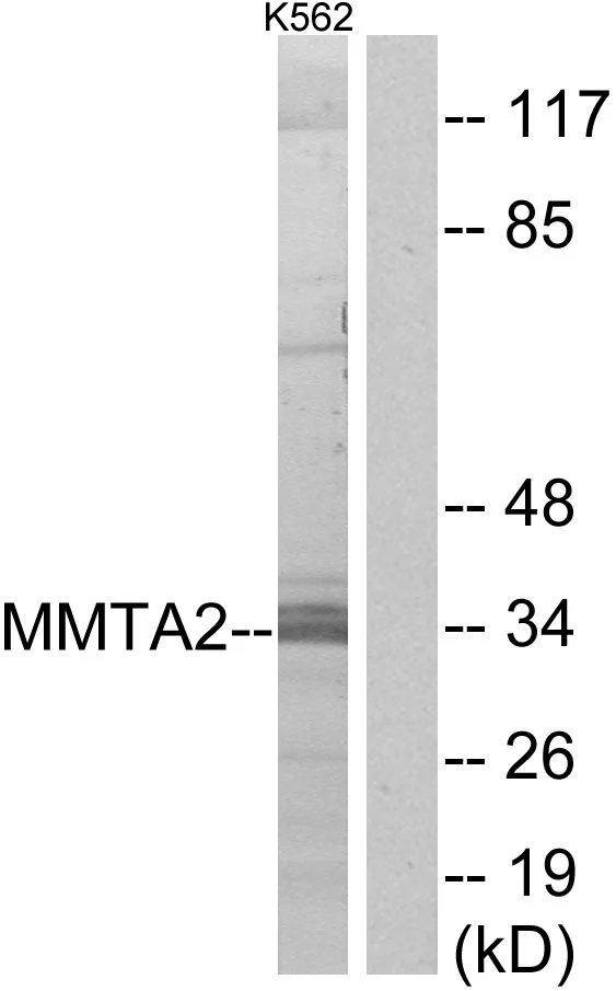 WB analysis of K562 cell lysates using GTX87017 MMTAG2 antibody. The lane on the right is blocked with the synthesized peptide. WB analysis of K562 cell lysates using GTX87017 MMTAG2 antibody. The lane on the right is blocked with the synthesized peptide.