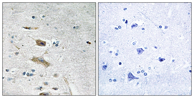 IHC-P analysis of human brain tissue using GTX87018 ABHD4 antibody. The picture on the right is blocked with the synthesized peptide. IHC-P analysis of human brain tissue using GTX87018 ABHD4 antibody. The picture on the right is blocked with the synthesized peptide.
