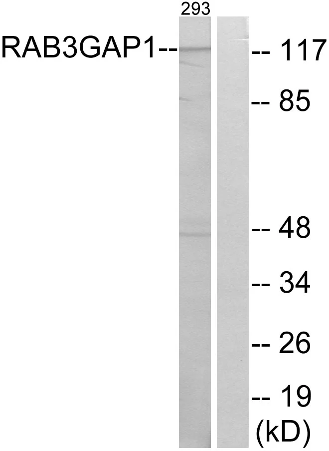 WB analysis of 293 cell lysates using GTX87019 RAB3GAP1 antibody. The lane on the right is blocked with the synthesized peptide.