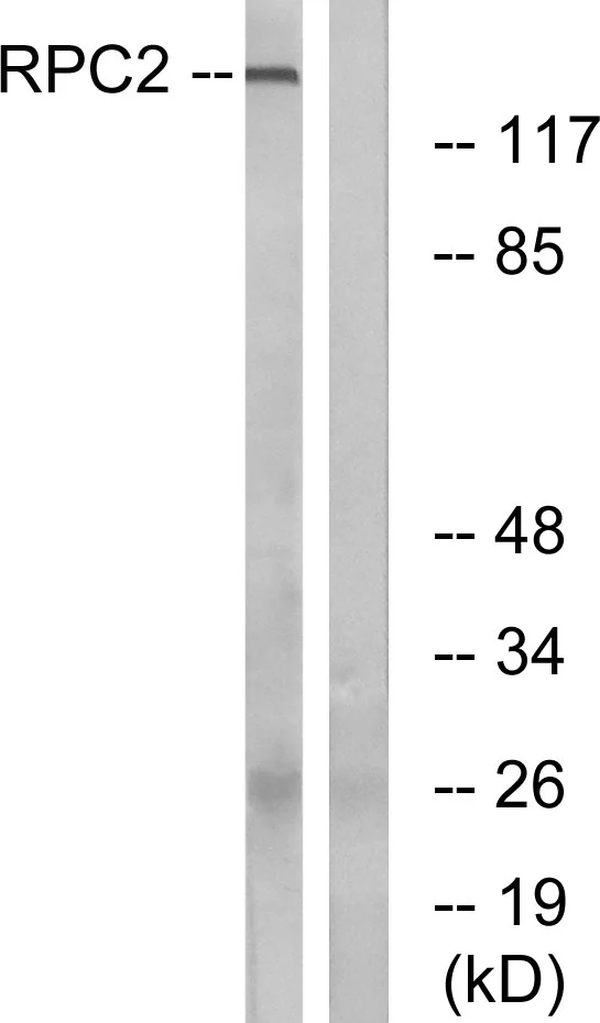 WB analysis of LOVO cell lysates using GTX87020 POLR3B antibody. The lane on the right is blocked with the synthesized peptide.