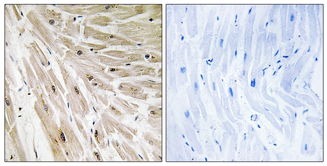 IHC-P analysis of human heart tissue using GTX87028 RPL22 antibody. The picture on the right is blocked with the synthesized peptide.