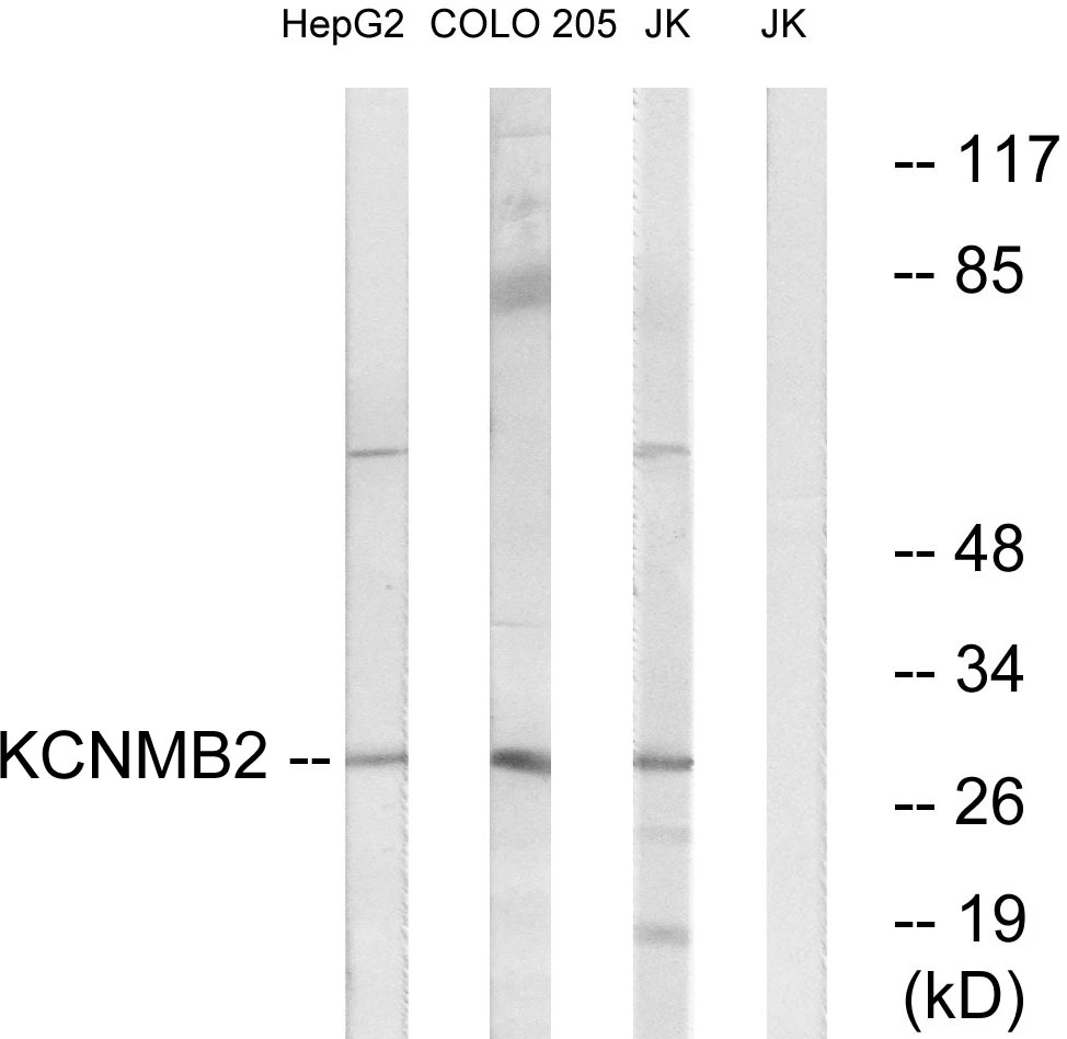 WB analysis of Jurkat, COLO, and HepG2 cell lysates using GTX87038 KCNMB2 antibody. The lane on the right is blocked with the synthesized peptide. WB analysis of Jurkat, COLO, and HepG2 cell lysates using GTX87038 KCNMB2 antibody. The lane on the right is blocked with the synthesized peptide.