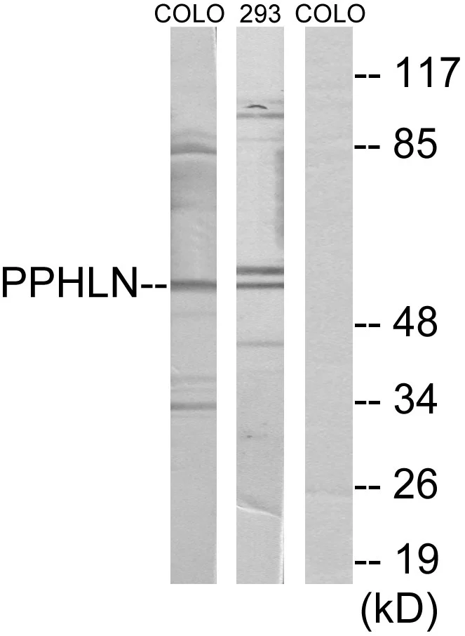WB analysis of COLO and 293 cell lysates using GTX87045 PPHLN antibody. The lane on the right is blocked with the synthesized peptide.