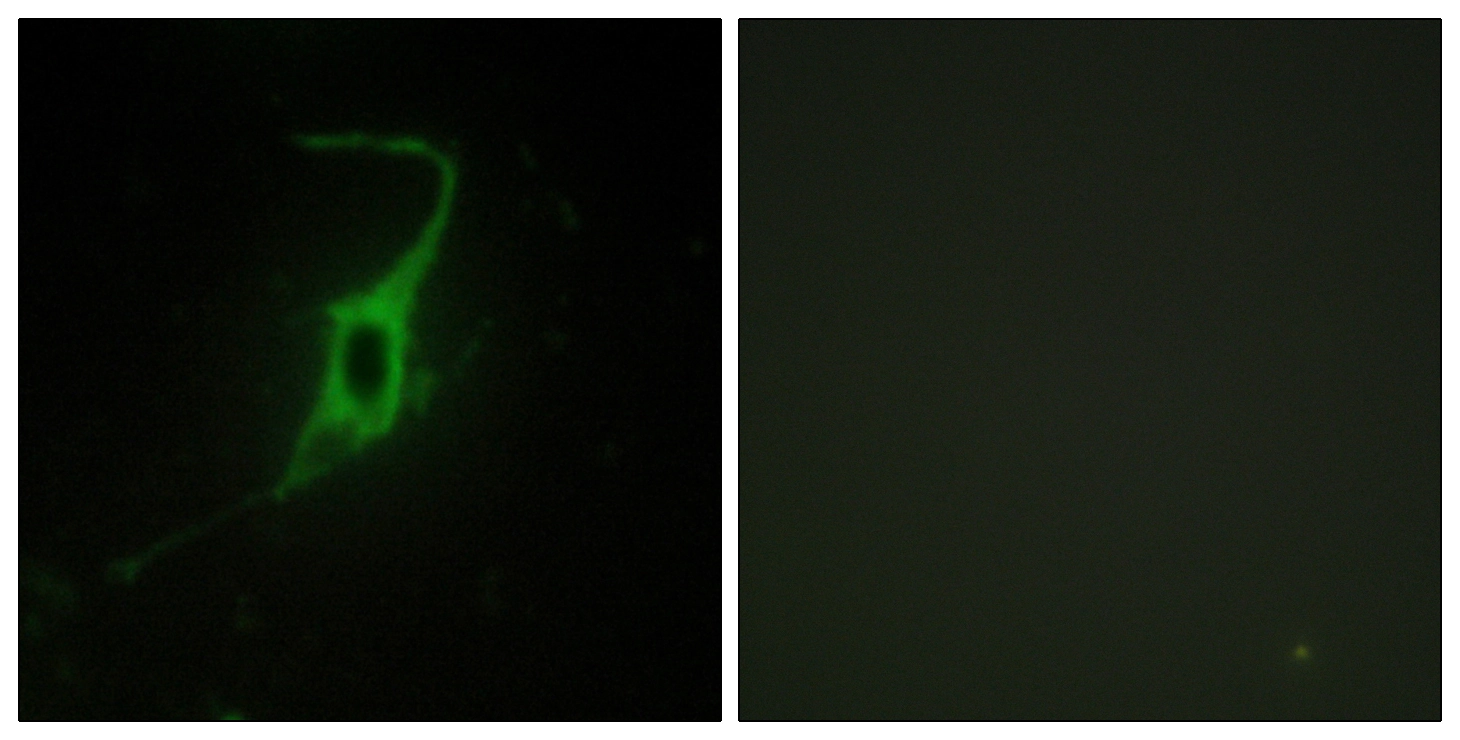 ICC/IF analysis of NIH3T3 cells using GTX87050 CDH20 antibody. The picture on the right is blocked with the synthesized peptide. ICC/IF analysis of NIH3T3 cells using GTX87050 CDH20 antibody. The picture on the right is blocked with the synthesized peptide.