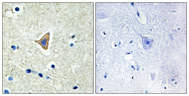 IHC-P analysis of human brain tissue using GTX87050 CDH20 antibody. The picture on the right is blocked with the synthesized peptide.