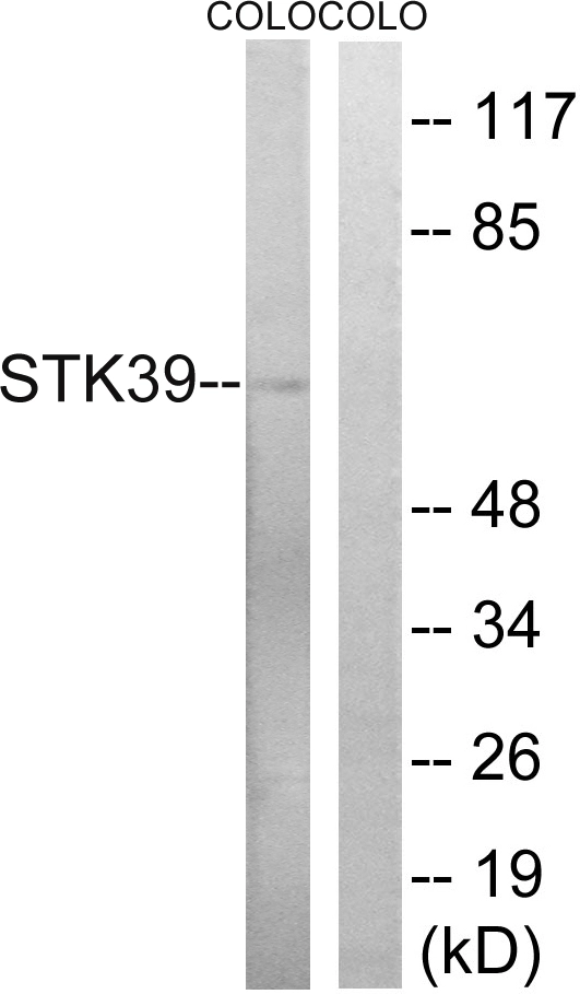 WB analysis of COLO cell lysates using GTX87052 STK39 antibody. The lane on the right is blocked with the synthesized peptide. WB analysis of COLO cell lysates using GTX87052 STK39 antibody. The lane on the right is blocked with the synthesized peptide.