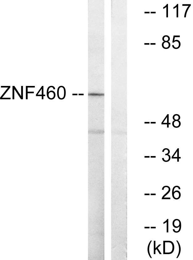 WB analysis of LOVO cell lysates using GTX87066 ZNF460 antibody. The lane on the right is blocked with the synthesized peptide. WB analysis of LOVO cell lysates using GTX87066 ZNF460 antibody. The lane on the right is blocked with the synthesized peptide.