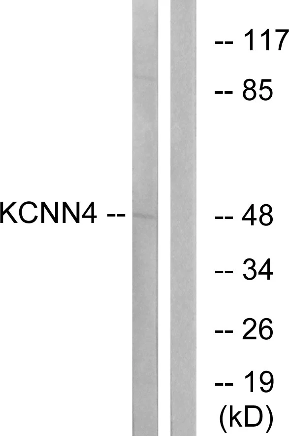 WB analysis of HepG2 cell lysates using GTX87069 KCNN4 antibody. The lane on the right is blocked with the synthesized peptide. WB analysis of HepG2 cell lysates using GTX87069 KCNN4 antibody. The lane on the right is blocked with the synthesized peptide.