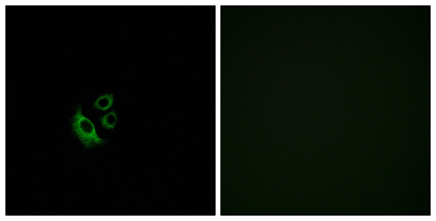ICC/IF analysis of A549 cells using GTX87074 OR2AG1 + OR2AG2 antibody. The picture on the right is blocked with the synthesized peptide. ICC/IF analysis of A549 cells using GTX87074 OR2AG1 + OR2AG2 antibody. The picture on the right is blocked with the synthesized peptide.