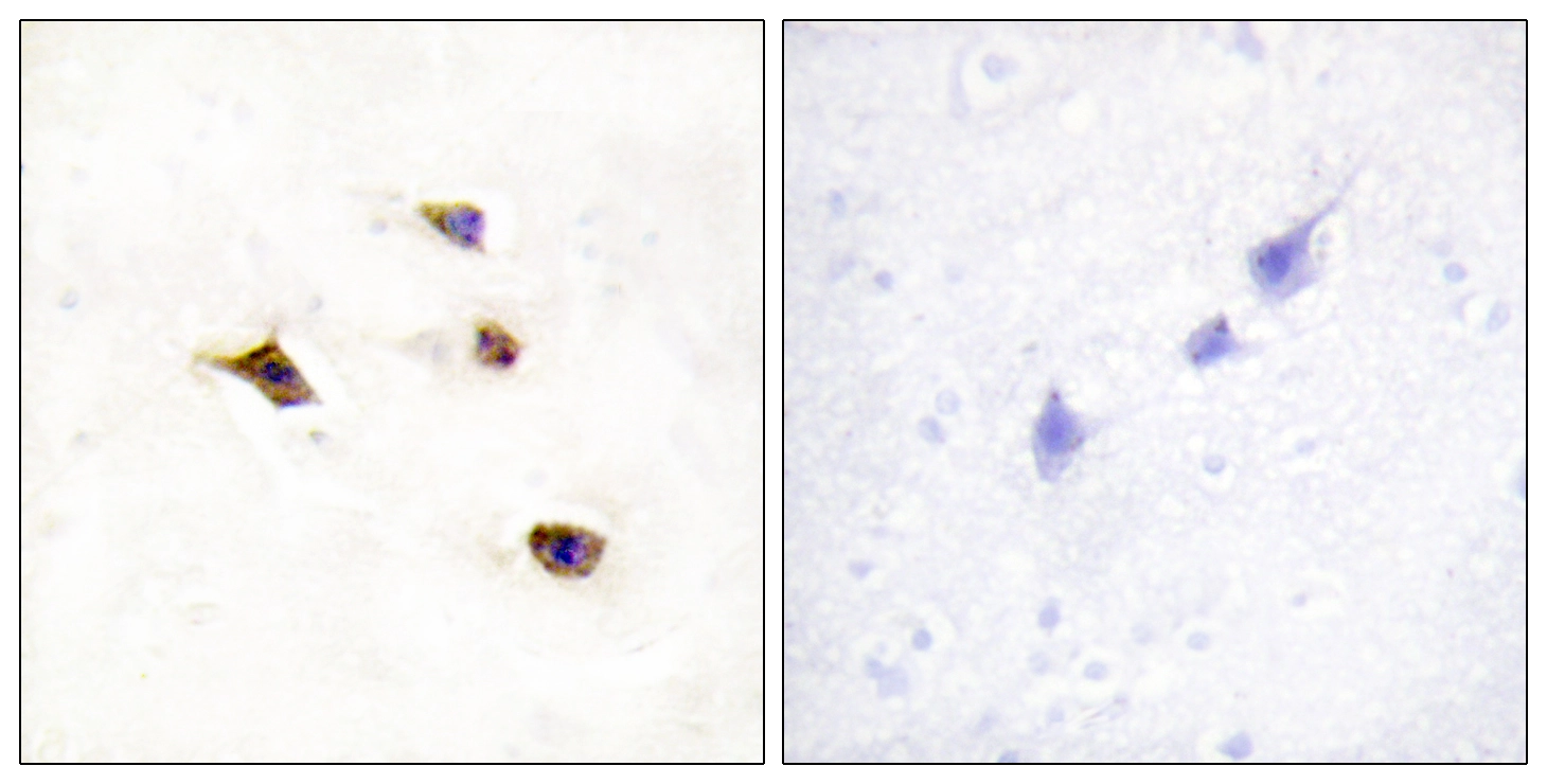 IHC-P analysis of human brain tissue using GTX87084 IP6K3 antibody. The picture on the right is blocked with the synthesized peptide. IHC-P analysis of human brain tissue using GTX87084 IP6K3 antibody. The picture on the right is blocked with the synthesized peptide.