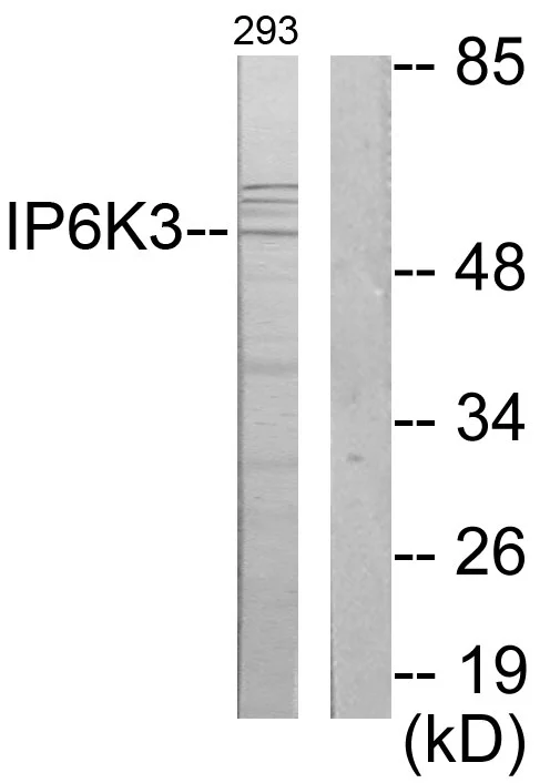 WB analysis of 293 cell lysates using GTX87084 IP6K3 antibody. The lane on the right is blocked with the synthesized peptide.