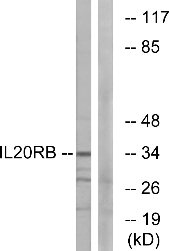 WB analysis of HeLa cell lysates using GTX87090 IL20RB antibody. The lane on the right is blocked with the synthesized peptide.