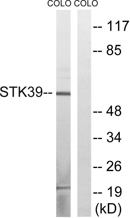 WB analysis of COLO cell lysates using GTX87091 STK39 antibody. The lane on the right is blocked with the synthesized peptide. WB analysis of COLO cell lysates using GTX87091 STK39 antibody. The lane on the right is blocked with the synthesized peptide.