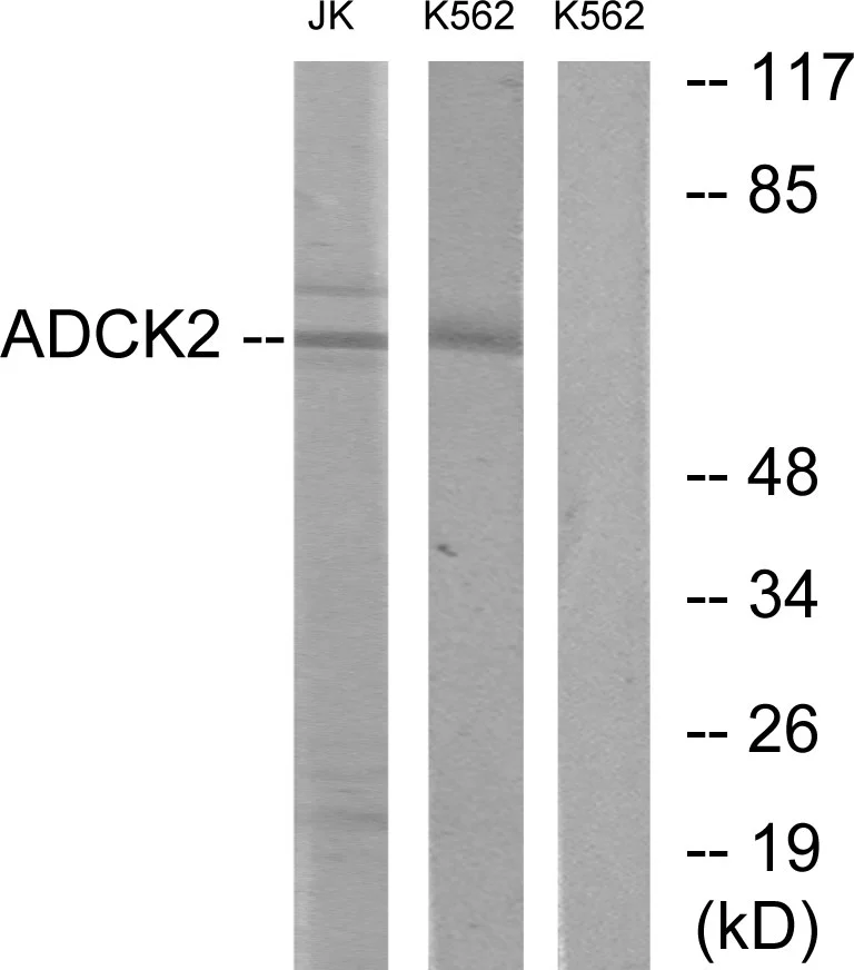 WB analysis of Jurkat and K562 cell lysates using GTX87105 ADCK2 antibody. The lane on the right is blocked with the synthesized peptide. WB analysis of Jurkat and K562 cell lysates using GTX87105 ADCK2 antibody. The lane on the right is blocked with the synthesized peptide.