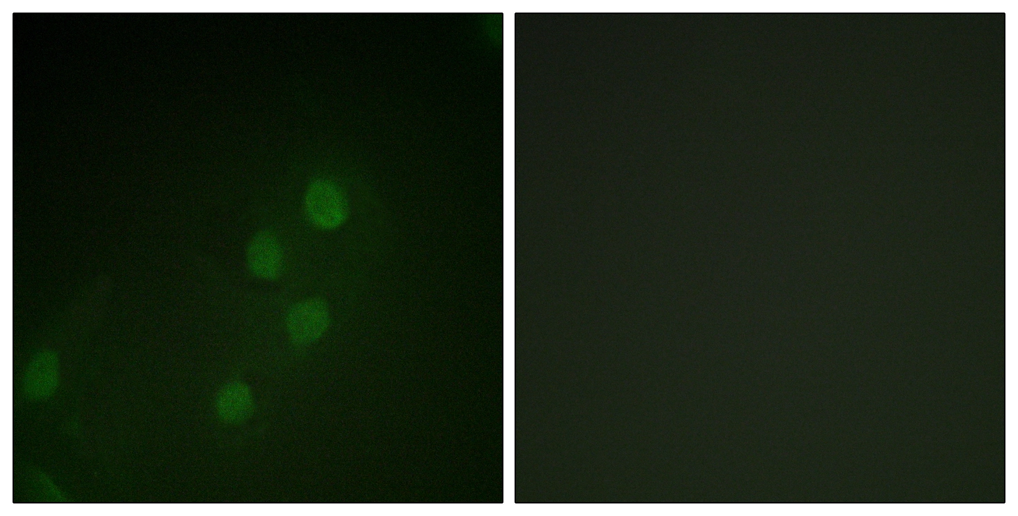 ICC/IF analysis of HeLa cells using GTX87110 MYF5 antibody. The picture on the right is blocked with the synthesized peptide. ICC/IF analysis of HeLa cells using GTX87110 MYF5 antibody. The picture on the right is blocked with the synthesized peptide.