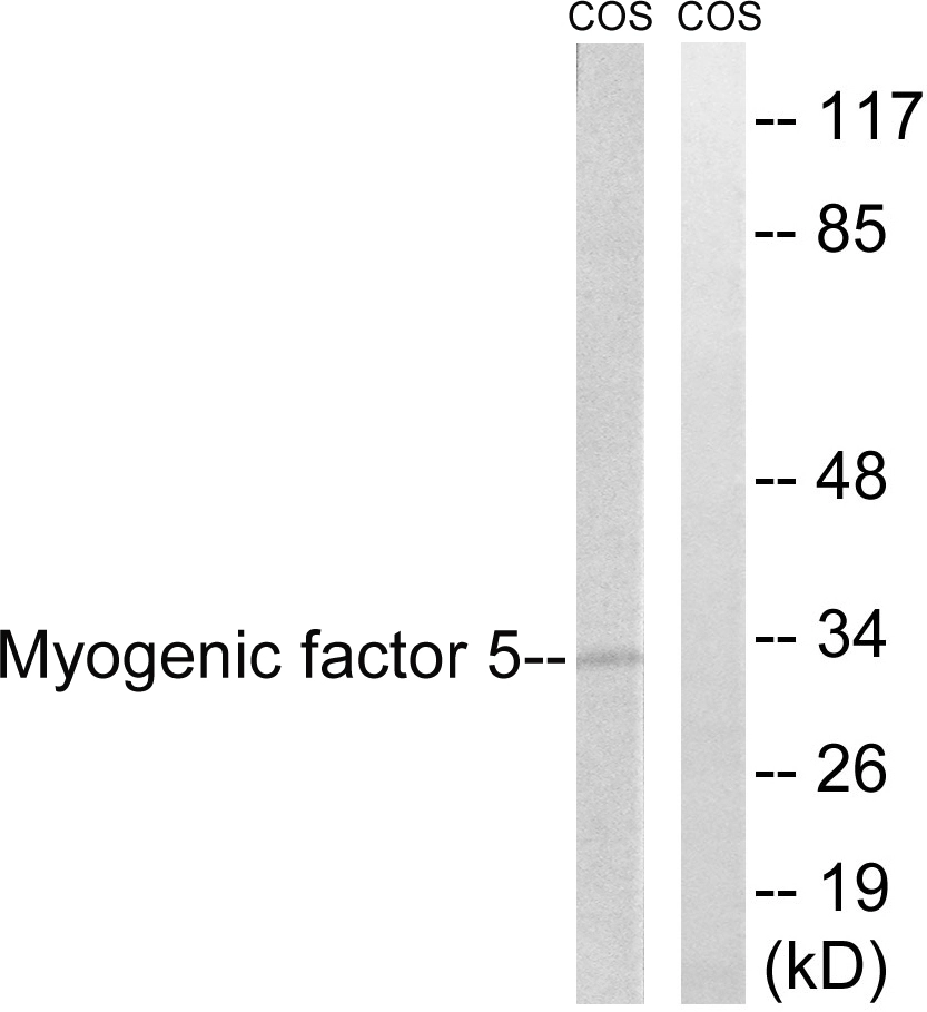 WB analysis of COS7 cell lysates using GTX87110 MYF5 antibody. The lane on the right is blocked with the synthesized peptide.