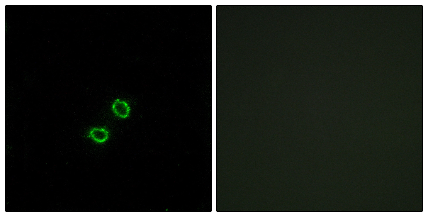ICC/IF analysis of A549 cells using GTX87112 KIR2DL5B antibody. The picture on the right is blocked with the synthesized peptide. ICC/IF analysis of A549 cells using GTX87112 KIR2DL5B antibody. The picture on the right is blocked with the synthesized peptide.
