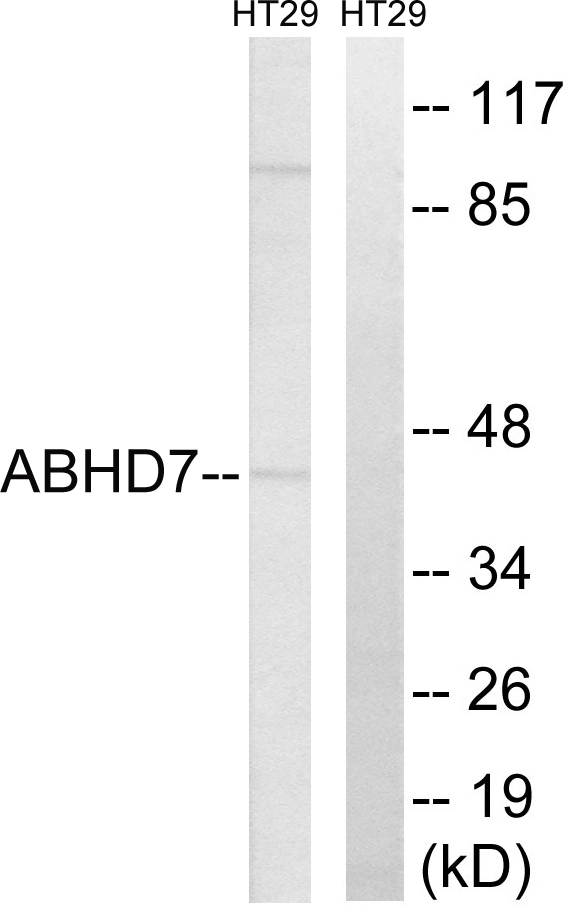 WB analysis of HT-29 cell lysates using GTX87116 ABHD7 antibody. The lane on the right is blocked with the synthesized peptide. WB analysis of HT-29 cell lysates using GTX87116 ABHD7 antibody. The lane on the right is blocked with the synthesized peptide.