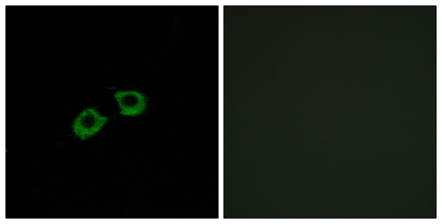 ICC/IF analysis of A549 cells using GTX87126 ARFGEF2 antibody. The picture on the right is blocked with the synthesized peptide. ICC/IF analysis of A549 cells using GTX87126 ARFGEF2 antibody. The picture on the right is blocked with the synthesized peptide.