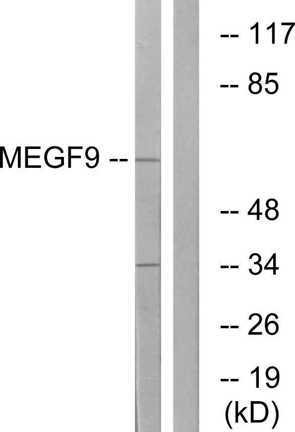 WB analysis of COLO cell lysates using GTX87136 MEGF9 antibody. The lane on the right is blocked with the synthesized peptide. WB analysis of COLO cell lysates using GTX87136 MEGF9 antibody. The lane on the right is blocked with the synthesized peptide.