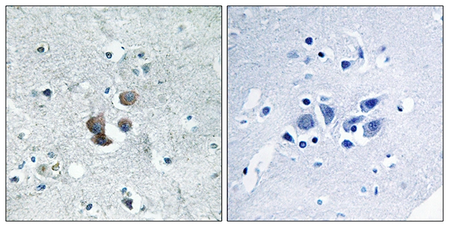 IHC-P analysis of human brain tissue using GTX87146 IGFBP7 antibody. The picture on the right is blocked with the synthesized peptide. IHC-P analysis of human brain tissue using GTX87146 IGFBP7 antibody. The picture on the right is blocked with the synthesized peptide.