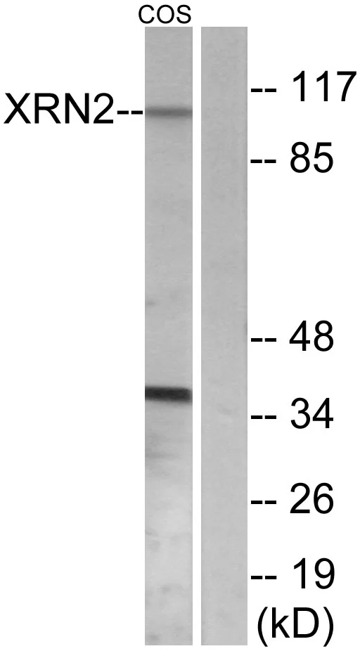 WB analysis of COS7 cell lysates using GTX87148 XRN2 antibody. The lane on the right is blocked with the synthesized peptide.