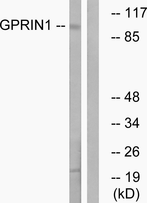 WB analysis of HT-29 cell lysates using GTX87160 GPRIN1 antibody. The lane on the right is blocked with the synthesized peptide. WB analysis of HT-29 cell lysates using GTX87160 GPRIN1 antibody. The lane on the right is blocked with the synthesized peptide.
