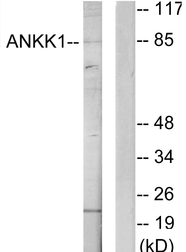 WB analysis of HeLa cell lysates using GTX87164 ANKK1 antibody. The lane on the right is blocked with the synthesized peptide. WB analysis of HeLa cell lysates using GTX87164 ANKK1 antibody. The lane on the right is blocked with the synthesized peptide.