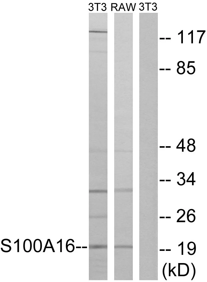 WB analysis of NIH/3T3 and RAW264.7 cell lysates using GTX87170 S100A16 antibody. The lane on the right is blocked with the synthesized peptide. WB analysis of NIH/3T3 and RAW264.7 cell lysates using GTX87170 S100A16 antibody. The lane on the right is blocked with the synthesized peptide.