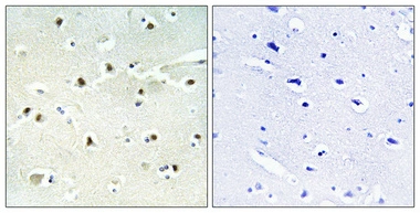 IHC-P analysis of human brain tissue using GTX87170 S100A16 antibody. The picture on the right is blocked with the synthesized peptide. Dilution: 1:100 Negative control (right) obtained from antibody was pre-absorbed by immunogen peptide.