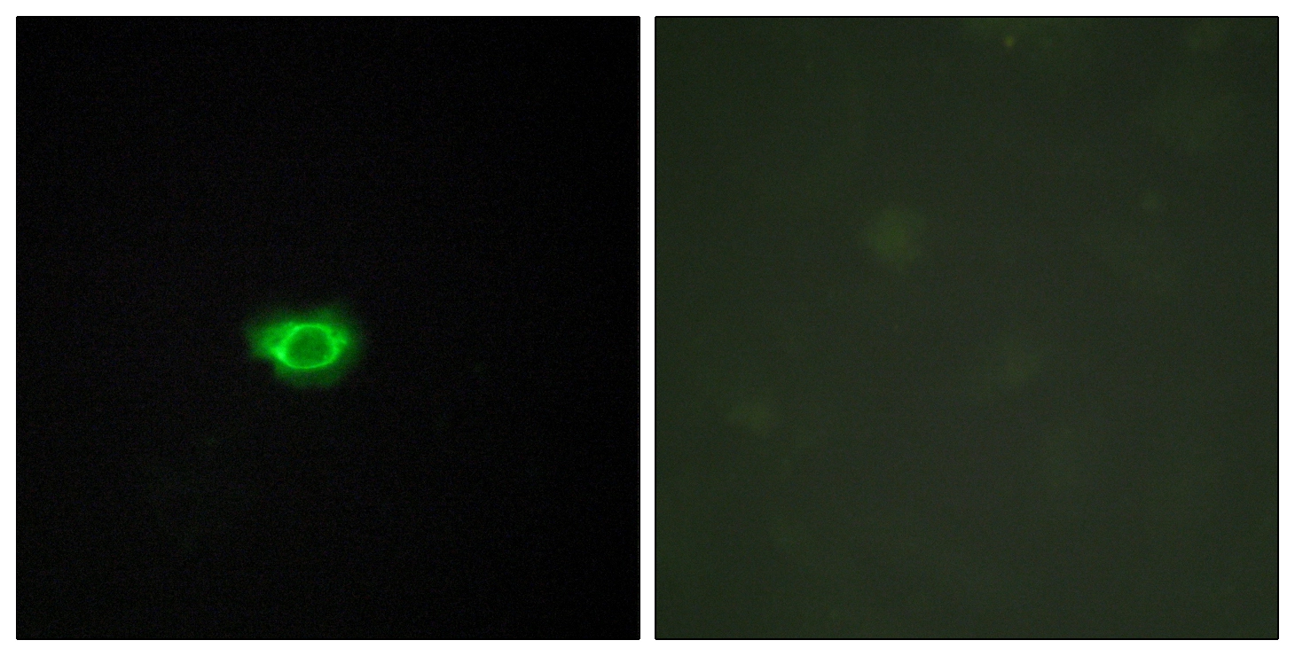 ICC/IF analysis of HUVEC cells using GTX87178 GPR108 antibody. The picture on the right is blocked with the synthesized peptide. ICC/IF analysis of HUVEC cells using GTX87178 GPR108 antibody. The picture on the right is blocked with the synthesized peptide.