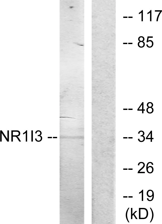 WB analysis of Jurkat cells treated with 20% serum (15mins) lysate using GTX87180 NR1I3 antibody. The lane on the right is blocked with the synthesized peptide.
