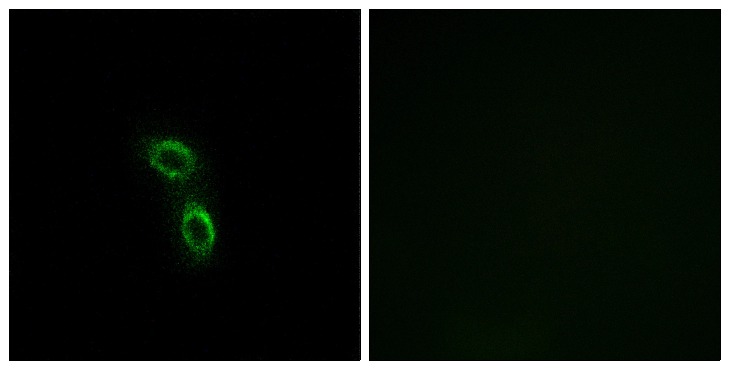 ICC/IF analysis of A549 cells using GTX87183 ARMC6 antibody. The picture on the right is blocked with the synthesized peptide. ICC/IF analysis of A549 cells using GTX87183 ARMC6 antibody. The picture on the right is blocked with the synthesized peptide.