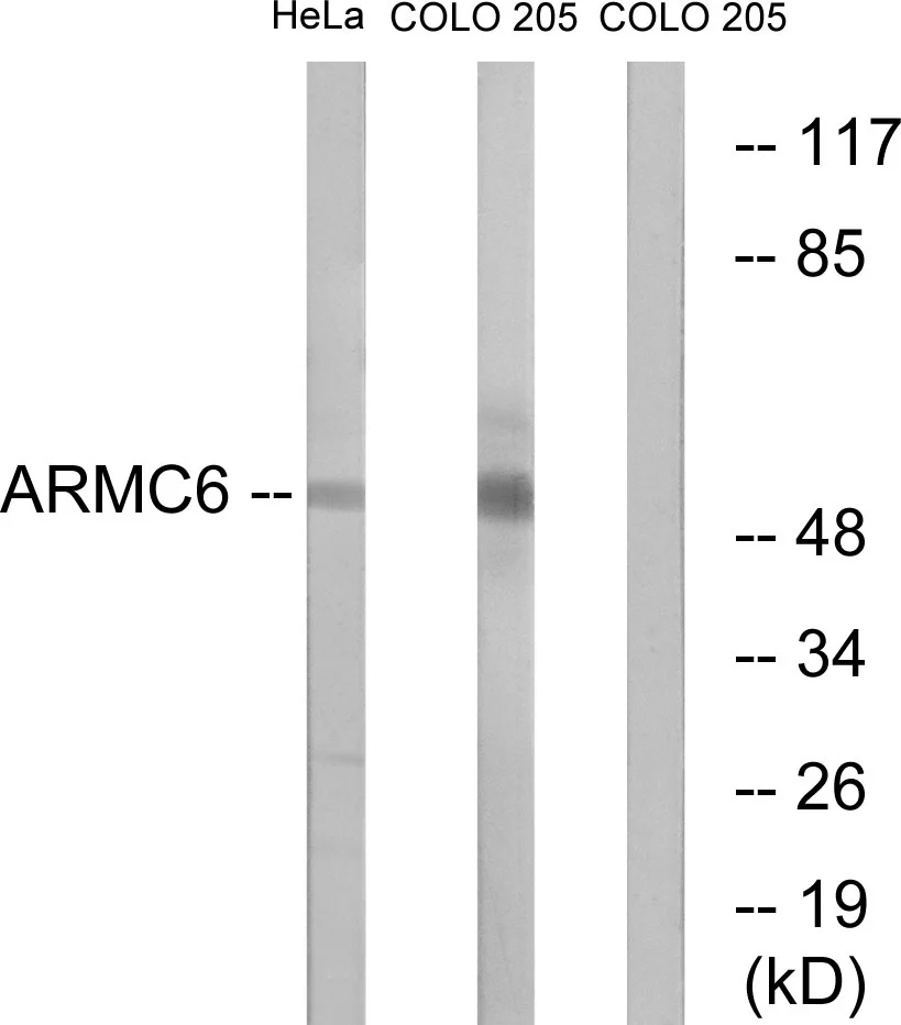 WB analysis of HeLa and COLO cell lysates using GTX87183 ARMC6 antibody. The lane on the right is blocked with the synthesized peptide.
