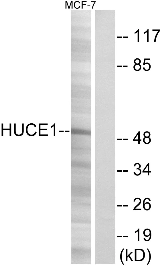 WB analysis of MCF-7 cell lysates using GTX87185 HUCE1 antibody. The lane on the right is blocked with the synthesized peptide. WB analysis of MCF-7 cell lysates using GTX87185 HUCE1 antibody. The lane on the right is blocked with the synthesized peptide.