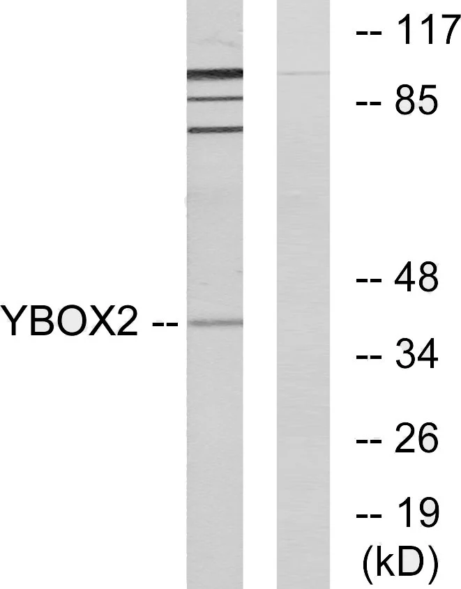 WB analysis of COLO205 cell lysates using GTX87205 YBX2 antibody. The lane on the right is blocked with the synthesized peptide.