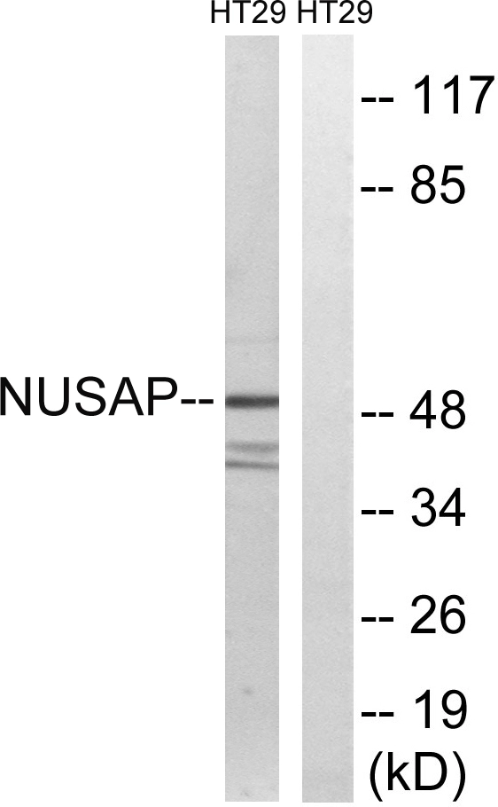 WB analysis of HT-29 cell lysates using GTX87221 NUSAP1 antibody. The lane on the right is blocked with the synthesized peptide. WB analysis of HT-29 cell lysates using GTX87221 NUSAP1 antibody. The lane on the right is blocked with the synthesized peptide.