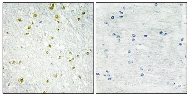 IHC-P analysis of human brain tissue using GTX87239 SNAPC5 antibody. The picture on the right is blocked with the synthesized peptide. IHC-P analysis of human brain tissue using GTX87239 SNAPC5 antibody. The picture on the right is blocked with the synthesized peptide.